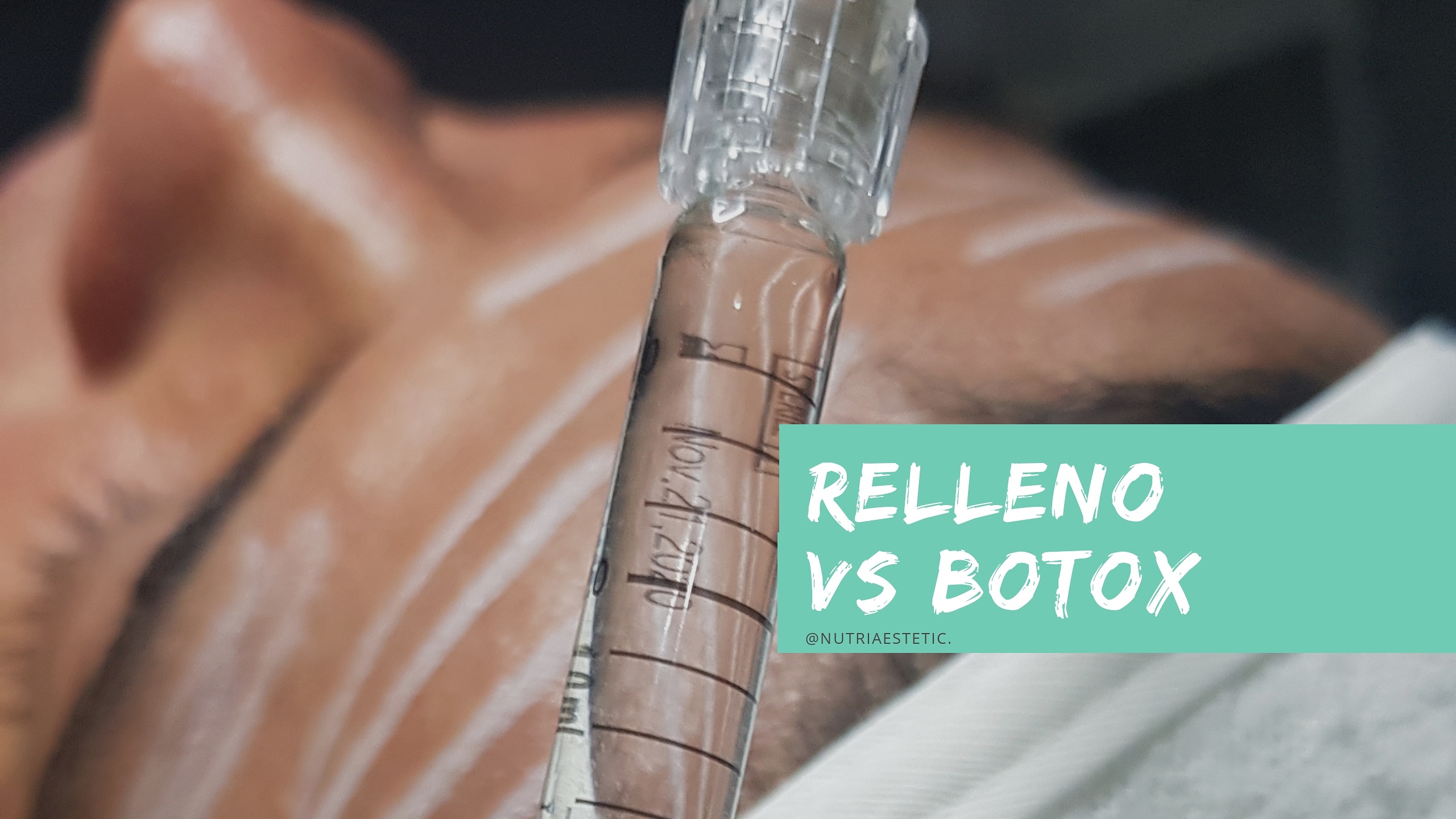 BOTOX VS ACIDO HIALURONICO